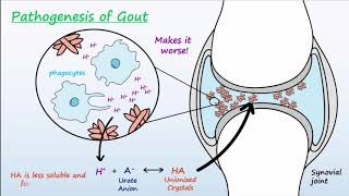 Gout  Mechanisms amp Treatment [upl. by Atrebla]