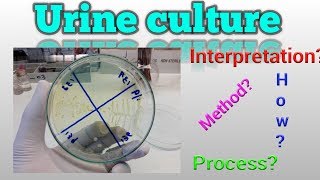 Urine culture test procedure Microbiology [upl. by Eceela823]