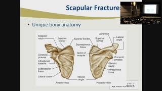 Lateral Clavicle  Dislocations and Fractures  The LCP Clavicle Hook Plate [upl. by Harshman]