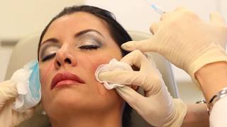 Sculptra Aesthetic  Dermal Filler Injectable  Dr Carolyn Jacob [upl. by Nesral510]