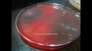 Urine Culture Colony Growth with Multiple Bacteria [upl. by Houser]