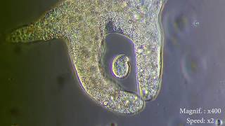 Amoeba eats paramecia  Amoebas lunch   Amoeba Endocytosis  Phagocytosis Part 1  👌 [upl. by Gerger]