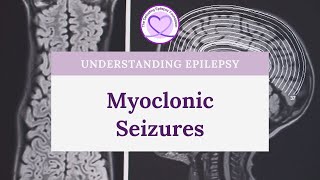 What are Myoclonic Seizures [upl. by Oakley]