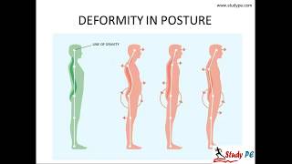 Human Skeleton  Body Movements  Science  Class 6 [upl. by Cynarra36]