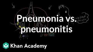 Pneumonia vs pneumonitis  Respiratory system diseases  NCLEXRN  Khan Academy [upl. by Shirline]