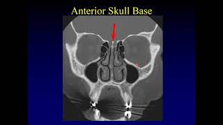 Anatomy of a Cervical xray [upl. by Harriet670]