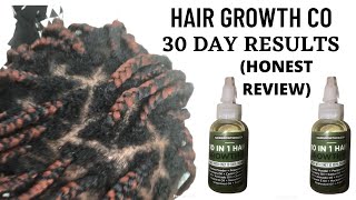 Hair Growth Co Oil 1 Month Results and Review [upl. by Lasyrc]