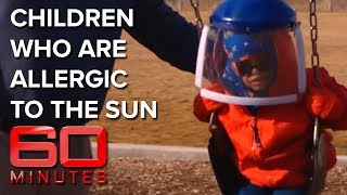 Children of the Night Young kids allergic to the sun  60 Minutes Australia [upl. by Chainey835]