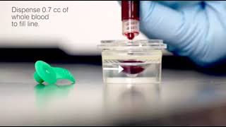 Catalyst® Lithium Heparin Whole Blood Separator [upl. by Arimak]