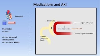 USMLE Renal 11 Acute Renal Failure and Azotemia Prerenal Intrarenal Postrenal [upl. by Alleunam]