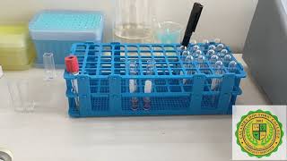 Glucose Measurment using Spectrophotometer [upl. by Rubens]