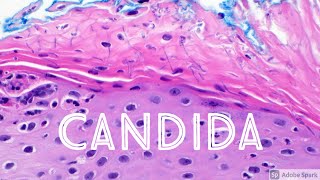 Candida Yeast Infection under microscope Candidiasis Dermatology Dermatopathology [upl. by Bird252]