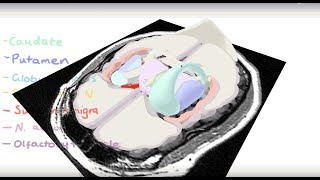 Basal Ganglia 3D Tour [upl. by Plerre102]