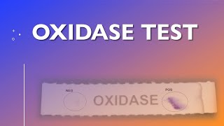 Oxidase Test [upl. by Amye]