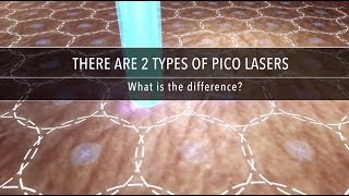 Why Are There Different Types of Pico Laser  Dr Kenneth Thean [upl. by Franciscka]