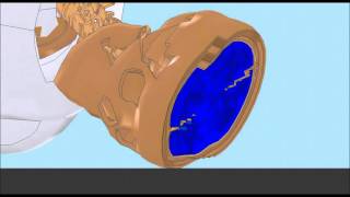 What happens to the brain without bike helmet during a crash [upl. by Hecker]