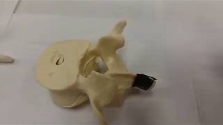 Typical Vertebra Parts 1 of 2 [upl. by Savell734]