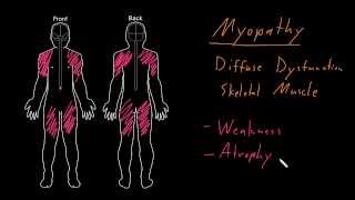 Myelopathy  Patient Education [upl. by Noscire24]