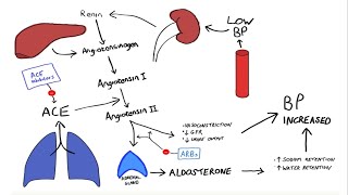 Glomerulonephritis Part2 [upl. by Trudie]