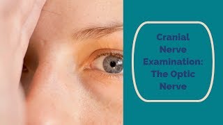 Cranial Nerve Examination CN 2 Optic nerve [upl. by Akemit749]