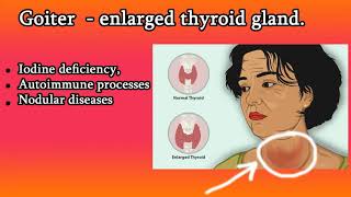 Toxic Multinodular Goiter Diagnosis and Treatment [upl. by Furlani792]