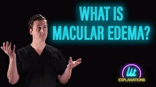 What Is Macular Edema [upl. by Noyr290]