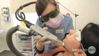 Laser Hair Removal  How does it work [upl. by Tnomad752]