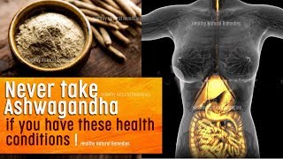 Never take Ashwagandha if you have these health conditions  Dosage Time Uses Side effects [upl. by Raine769]