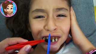 YESLY NECESITA UN DENTISTA URGENTE POR COMER MUCHOS DULCES  LA CARIES [upl. by Gad]