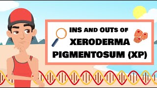 The Ins and Outs of XP Xeroderma pigmentosum [upl. by Fawne]