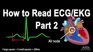 How to Read ECGEKG Part 2 Animation [upl. by Sairtemed]