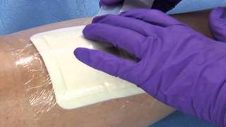 3M™ Tegaderm™ Foam Adhesive Dressing  Application and Removal [upl. by Spark]