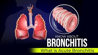 Bronchoscopy Procedure South West Acute Hospital [upl. by Mode391]