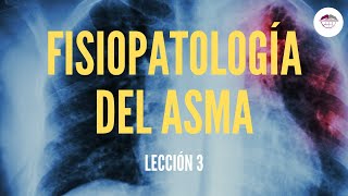 3 FISIOPATOLOGÍA DEL ASMA FISIOPATOLOGÍA RESPIRATORIA [upl. by Marsh]