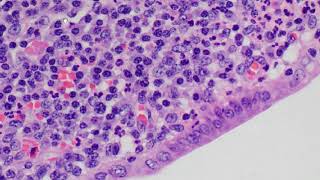 Leukocytes in histology [upl. by Jeni928]