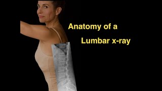 Anatomy of a Lumbar xray [upl. by Aan]