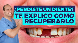 PERDÍ un DIENTE 😥 ¿Qúe Hago 31 SOLUCIONES Posibles 😉 [upl. by Soluk]