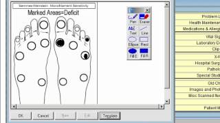 Deep Tendon Reflexes Stanford Medicine 25 [upl. by Simonsen409]